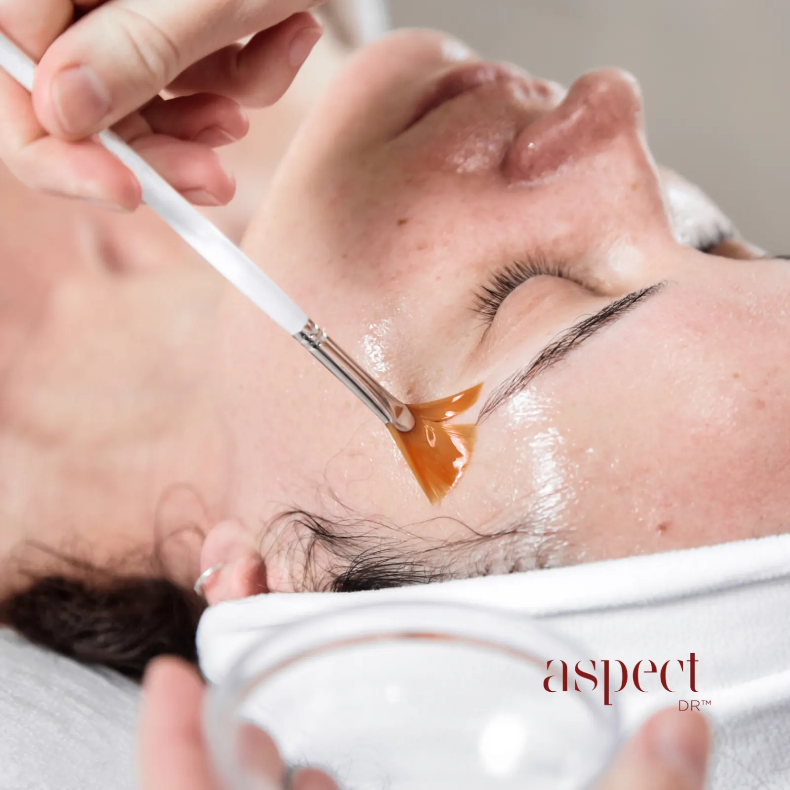 Client receiving Aspect facial treatment with cosmeceutical peel application
