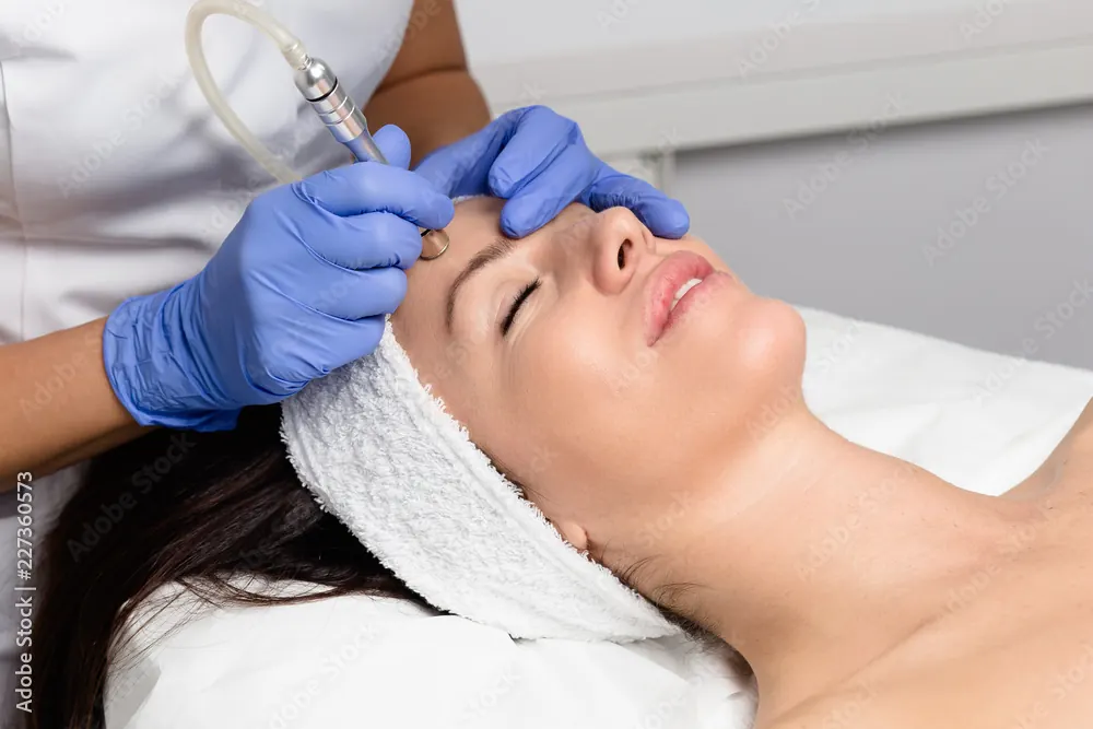 Professional skin refinement treatment for large pores and uneven skin texture at Soraya Skin Clinic Melbourne